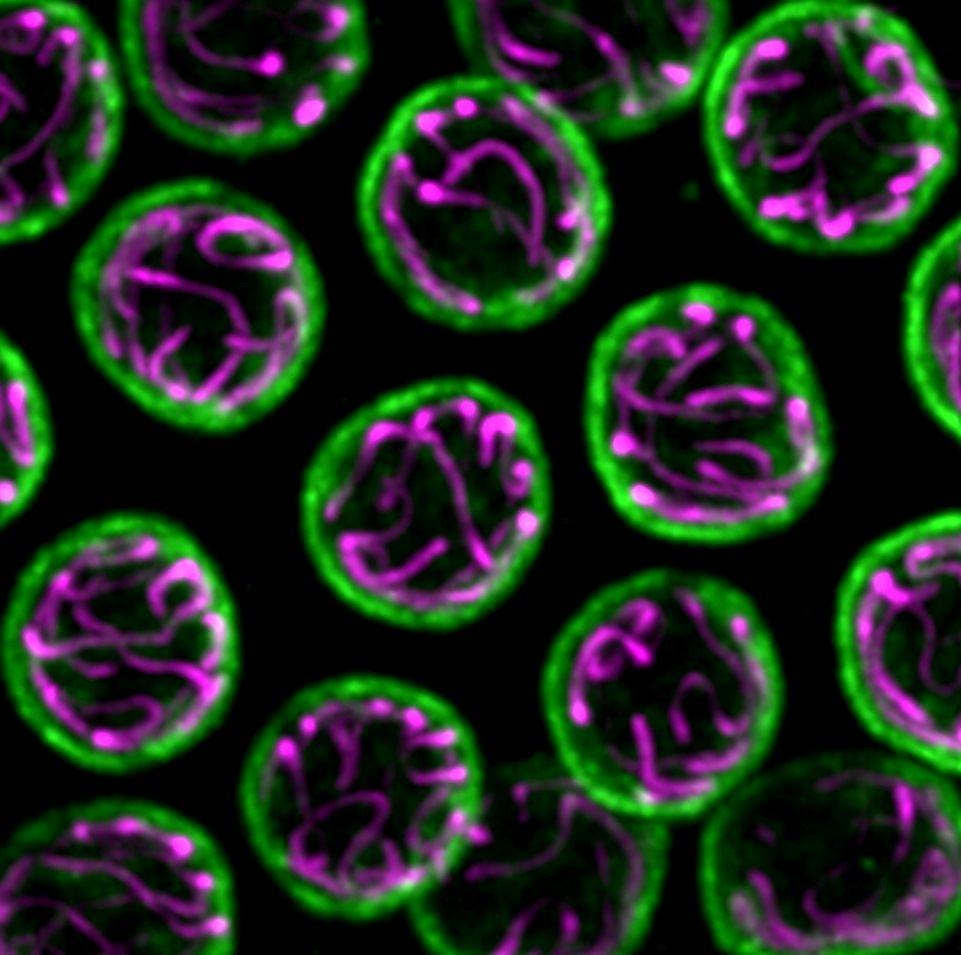 Chromosome nuclear Envelope